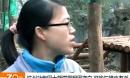 杭州动物园大熊猫黑眼圈变白可能与螨虫有关